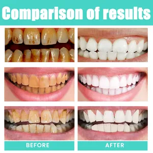 Comprehensive teeth whitening results comparison showing before and after effects of mouthwash.