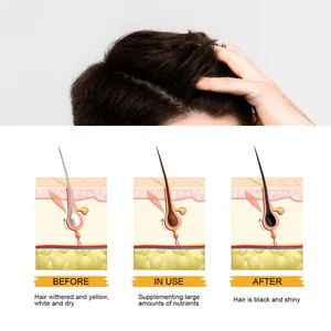 Diagram van haarfollikelvoeding en verdonkeringseffect voor de shampoo bar voor mannen.