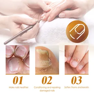 Macro detail of cuticle care gel repairing damaged nails and softening keratin.