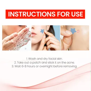 Stap-voor-stap gids voor het aanbrengen van blauwe stervormige hydrocolloïde acne pleisters