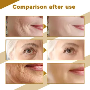 Skin texture comparison showing wrinkle reduction after using Centella essence