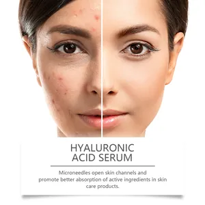 Detailed view of skin improvement results before and after using hyaluronic acid serum