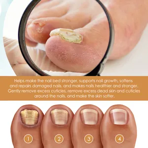 Professional cuticle care gel and repair treatment for damaged and weak toenails