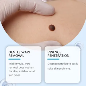 Primer plano del tratamiento de verrugas con fórmula suave para penetración.