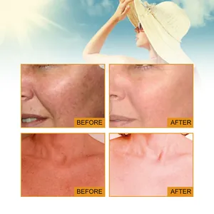 Detaillierter Vor-und-Nachher-Vergleich der Hauttonkorrektur mit UV-Sonnenschutzcreme