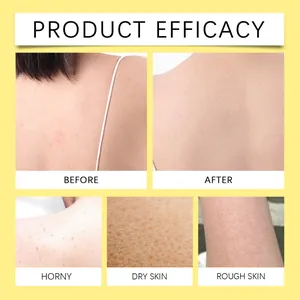 Before and after comparison of refreshing body wash on dry and rough skin texture