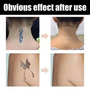 Confronto prima e dopo che mostra il correttore per tatuaggi che copre un design a farfalla