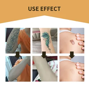 Voor en na vergelijking van waterdichte concealerpleisters voor tatoeages en littekens