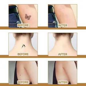 Waterproof huid concealer sticker voor en na vergelijking voor tatoeage en litteken