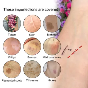 Dettaglio che mostra il correttore per tatuaggi che copre varie imperfezioni