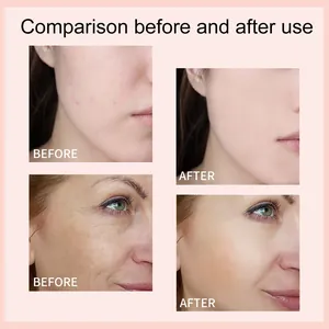Comparison showing the before and after coverage effects of hydrating foundation serum