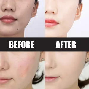 Resultados antes y después con EELHOE Magic Cushion base BB cream para cobertura total