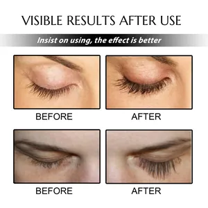 Detailed close-up comparison showing visible results of eyelash growth serum usage.