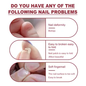 Infografía informativa que muestra problemas comunes de las uñas como deformidad y fragilidad