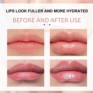 Vorher-Nachher-Vergleich einer feuchtigkeitsspendenden Lippenauffüllung für vollere Lippen