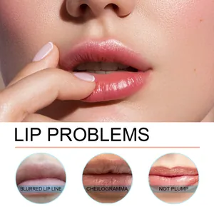 Detail view highlighting common lip concerns like blurred lines, wrinkles, and lack of volume