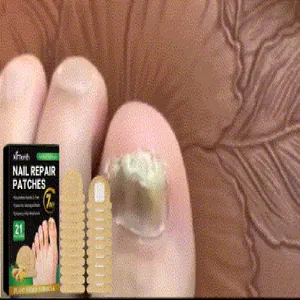 Detailansicht der XIMONTH Ingwer-Nagelpflaster zur effektiven Zehennagelbehandlung