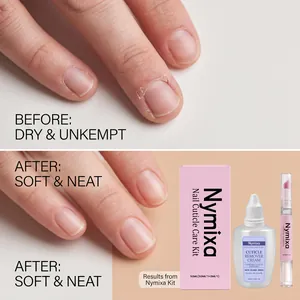 Detailed comparison showing before and after results of Nymixa nail cuticle kit