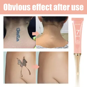 Confronto prima e dopo della crema EELHOE per la rimozione dei pigmenti e dei tatuaggi.