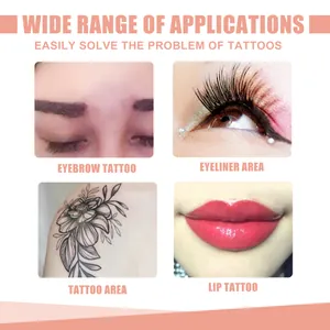Grafica dettagliata sulla rimozione di tatuaggi su sopracciglia, eyeliner, corpo e labbra
