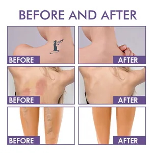 Detail showing before and after coverage of tattoos, scars, and varicose veins