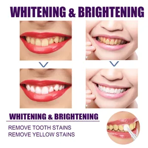 Professional before and after comparison of tooth whitening and brightening pen