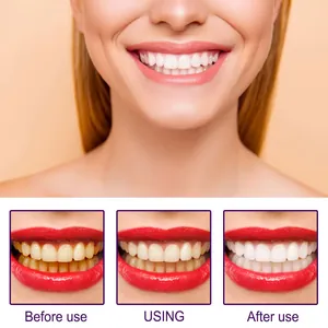 Visual comparison showing teeth whitening results before and after using the V34 pen.