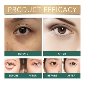 Demostración de eficacia de mascarillas de ojos para ojeras y bolsas en los ojos.