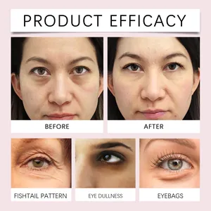 Efficacité du masque yeux sur rides et cernes avec comparaison avant et après