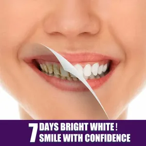 Teeth whitening effect of V34 purple tooth pen after 7 days of daily oral care use
