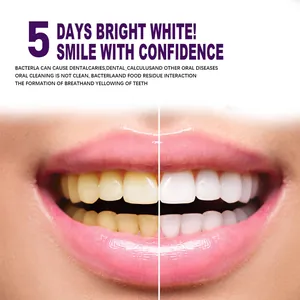 Comparison of teeth whitening results showing bright white smile after using V34 purple pen