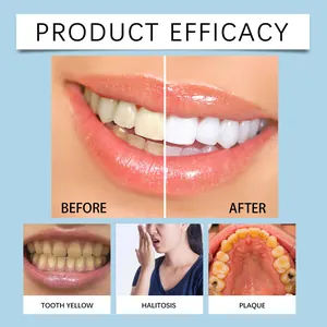 Detail showing teeth whitening efficacy before and after results for brightening