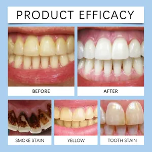 Comparaison de l'effet de blanchiment des dents montrant les résultats avant et après
