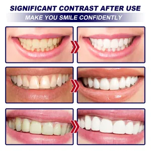 Comparison showing significant teeth whitening results before and after using strips
