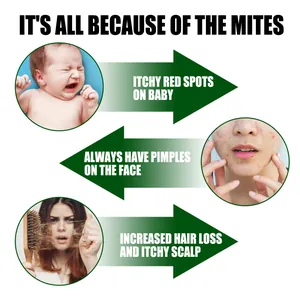 Infographic showing mite symptoms: baby skin spots, facial acne, and hair loss.