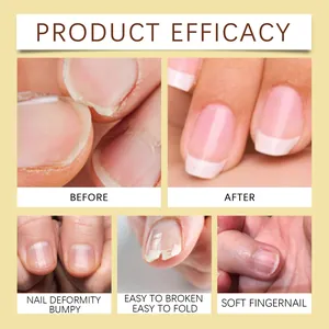 Before and after comparison of jojoba oil treatment for brittle and bumpy fingernails