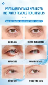 Before and after comparison of eye mist sprayer showing reduced dark circles and fine lines.