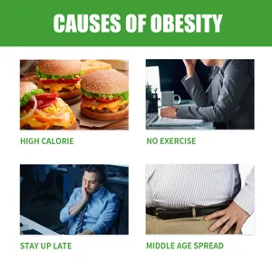Graphique informatif détaillant les causes de l'obésité comme les calories et l'inactivité