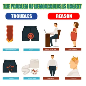 Infographic detailing hemorrhoid symptoms and causes for effective relief treatment detail.