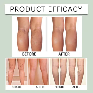 Leg sleeve efficacy comparison showing before and after results for daily leg care support.