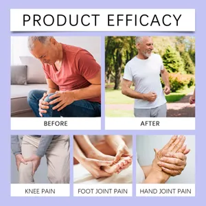 Joint pain relief cream efficacy demonstration for knee, foot and hand joint discomfort