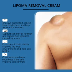Crème efficace d'élimination des lipomes montrant le traitement des grosseurs cutanées