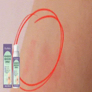 Detail van het effect van OCEAURA lijmverwijderaar spray op huidresten op de arm