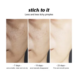 Facial cleansing soap skincare effect timeline showing pore refinement and acne reduction over days.