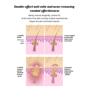Facial cleansing soap anti mite and acne removing natural plant essential oils care.