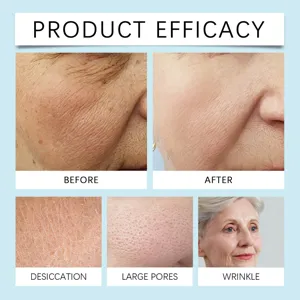 Gráfico de eficacia de la mascarilla facial que muestra el antes y después