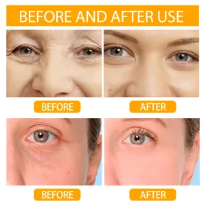 Before and after comparison showing under-eye wrinkle reduction from facial serum