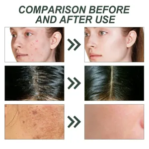 Gros plan avant après soin de la peau montrant une peau lisse et un visage clair.