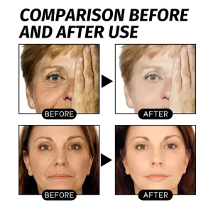 Vorher-Nachher-Vergleich der Retinol-Gesichtsmaske zur Hautstraffung und Faltenreduktion.