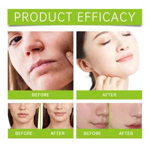 Green tea cleansing set skin care efficacy display before and after usage comparison